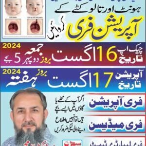 Free Operation